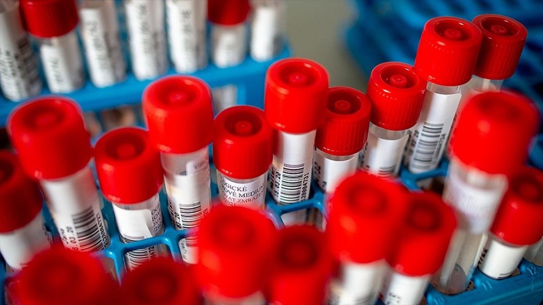 Sağlık Bakanlığı Referans Laboratuvarı'nda Kovid-19 Virüsü İzole Edildi