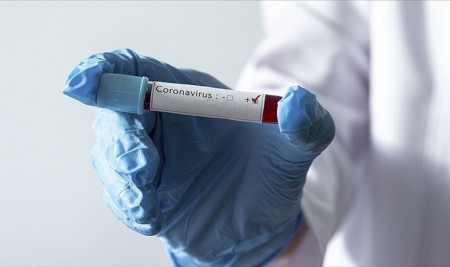 Dünya Genelinde Kovid-19 Vaka Sayısı 1 Milyon 700 Bini Aştı